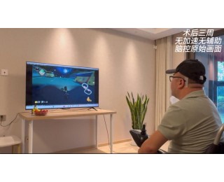 我国成功开展首例侵入式脑机接口临床试验