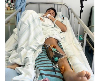 退伍不褪色！为保护同事和群众安全，武汉辅警被逆行闯岗的摩托车撞成骨折，他说“伤好了，我还要回路口守着”