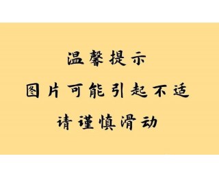 市民近期在汉口江滩两次遇到毒蛇，湖北消防发布防蛇宝典